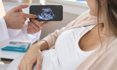 Ultrassom para Gestantes: Tudo o Que Saber